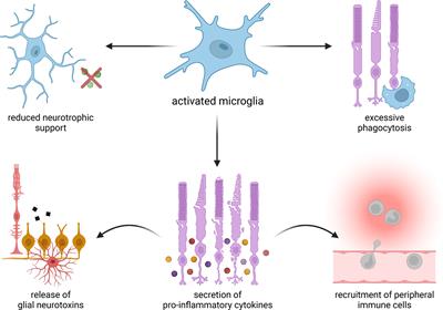 Targeting Microglia to Treat Degenerative Eye Diseases